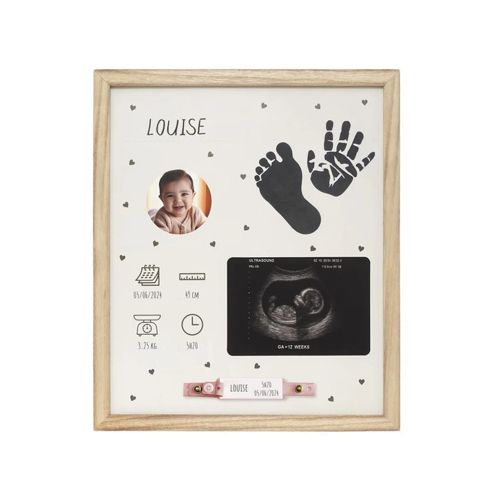 Petit Artichaut Birth Frame