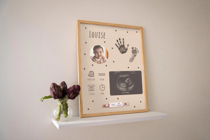 Petit Artichaut Birth Frame