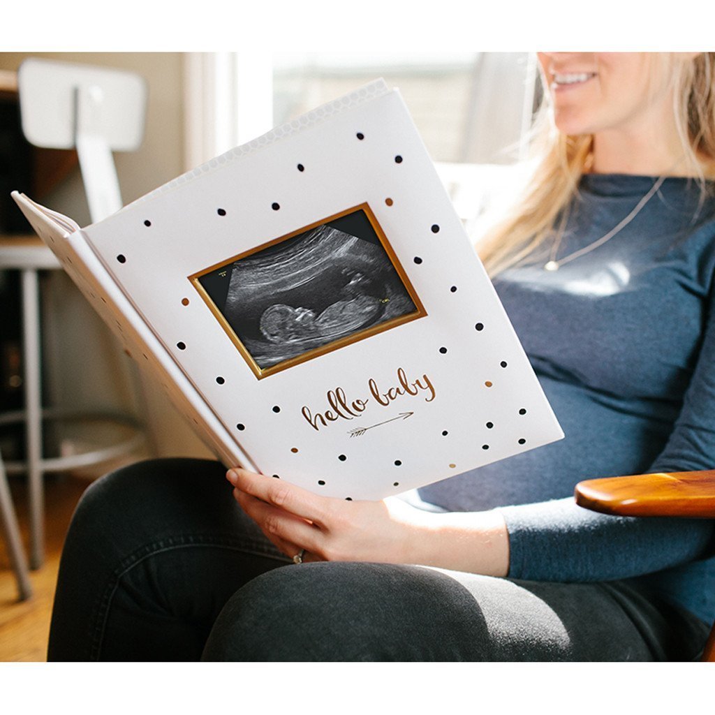 Pearhead Baby Book (Black, White & Gold)-Nursery-Pearhead-023540 SO-babyandme.ca