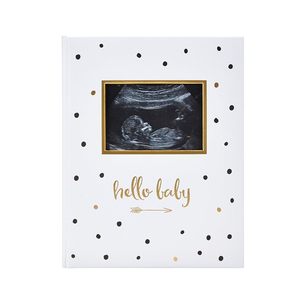 Pearhead Baby Book (Black, White & Gold)-Nursery-Pearhead-023540 SO-babyandme.ca